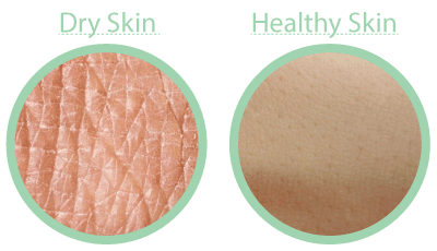 Why soap makes your skin feel tight.